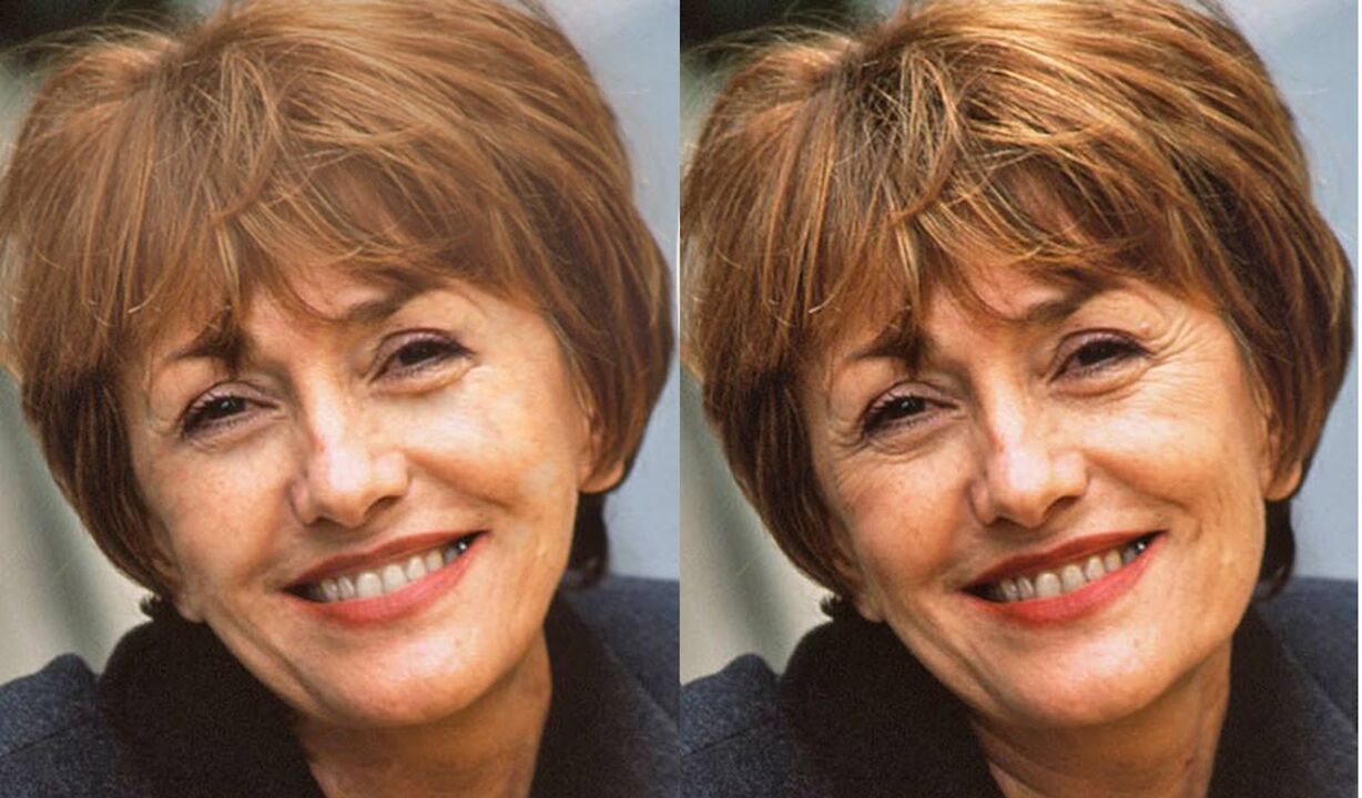 pictures of faces before and after contours