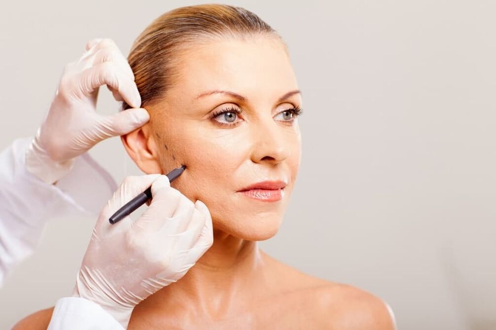 preparation for facelift surgery for adolescence