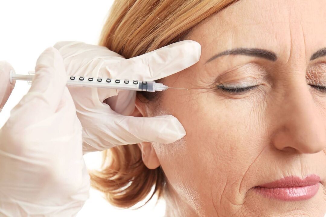 Mesotherapy is a procedure for intradermal administration of drugs with a rejuvenating effect. 
