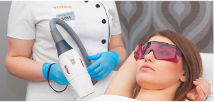 Facial rejuvenation with laser